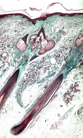 electron micrograph of a scalp skin section