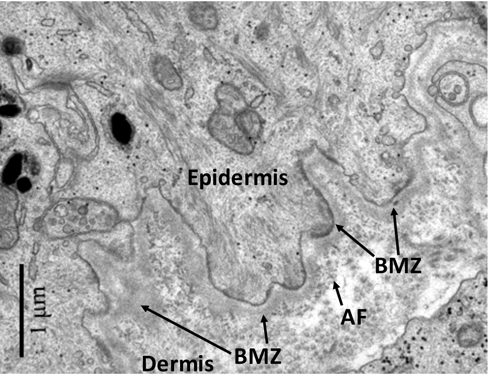 tem image of the basement membrane zone of skin