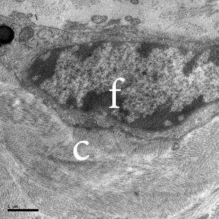 TEM image of a fibroblast and associated collagen fibers