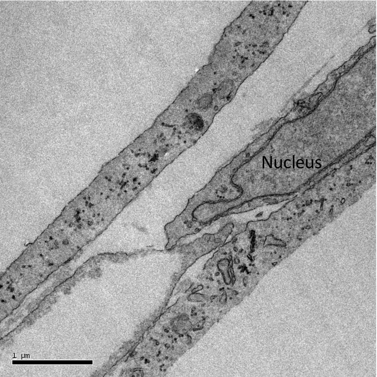 electron mircroscope image of a fibroblast