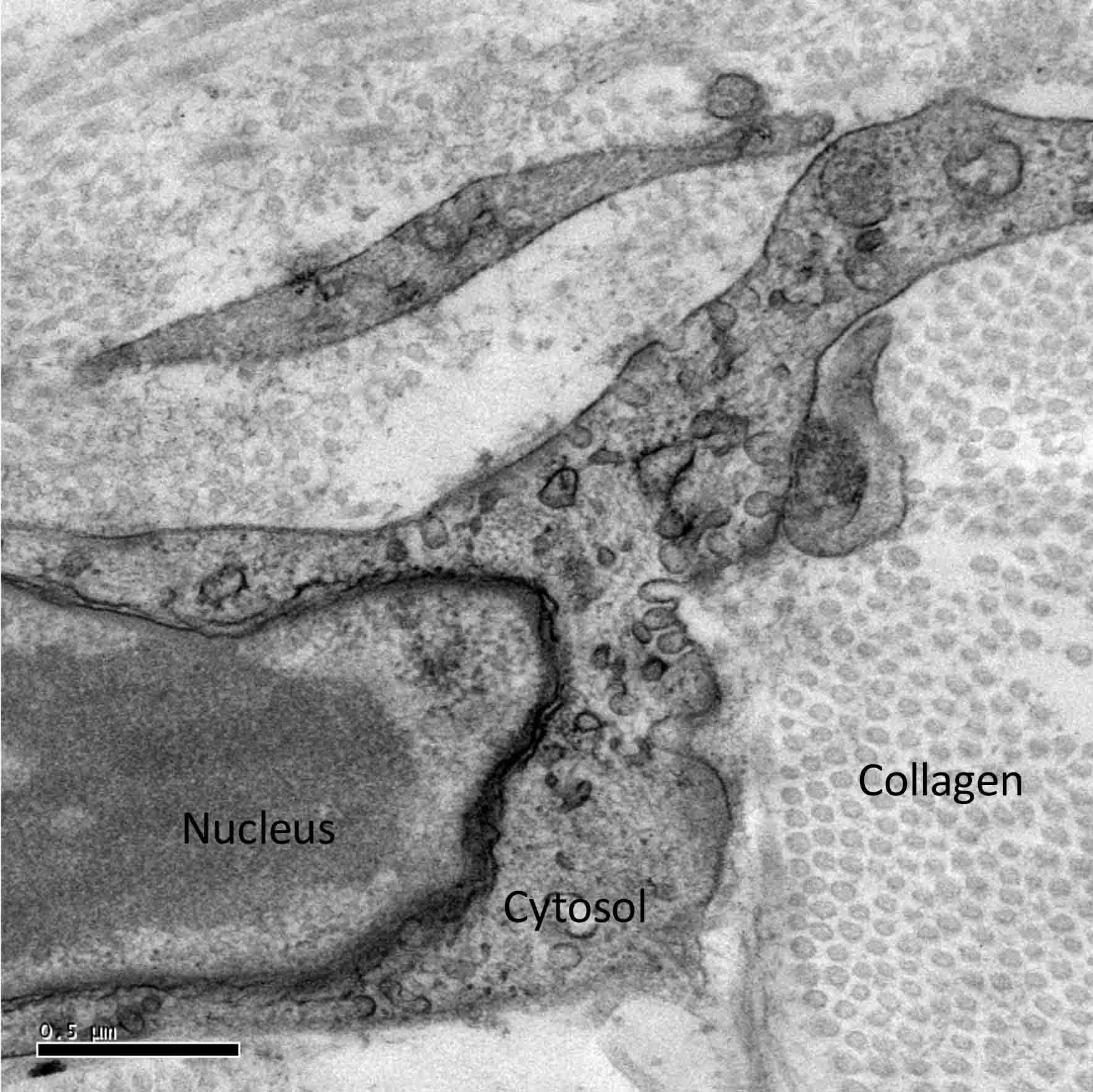 electron microscope image of a fibroblast
