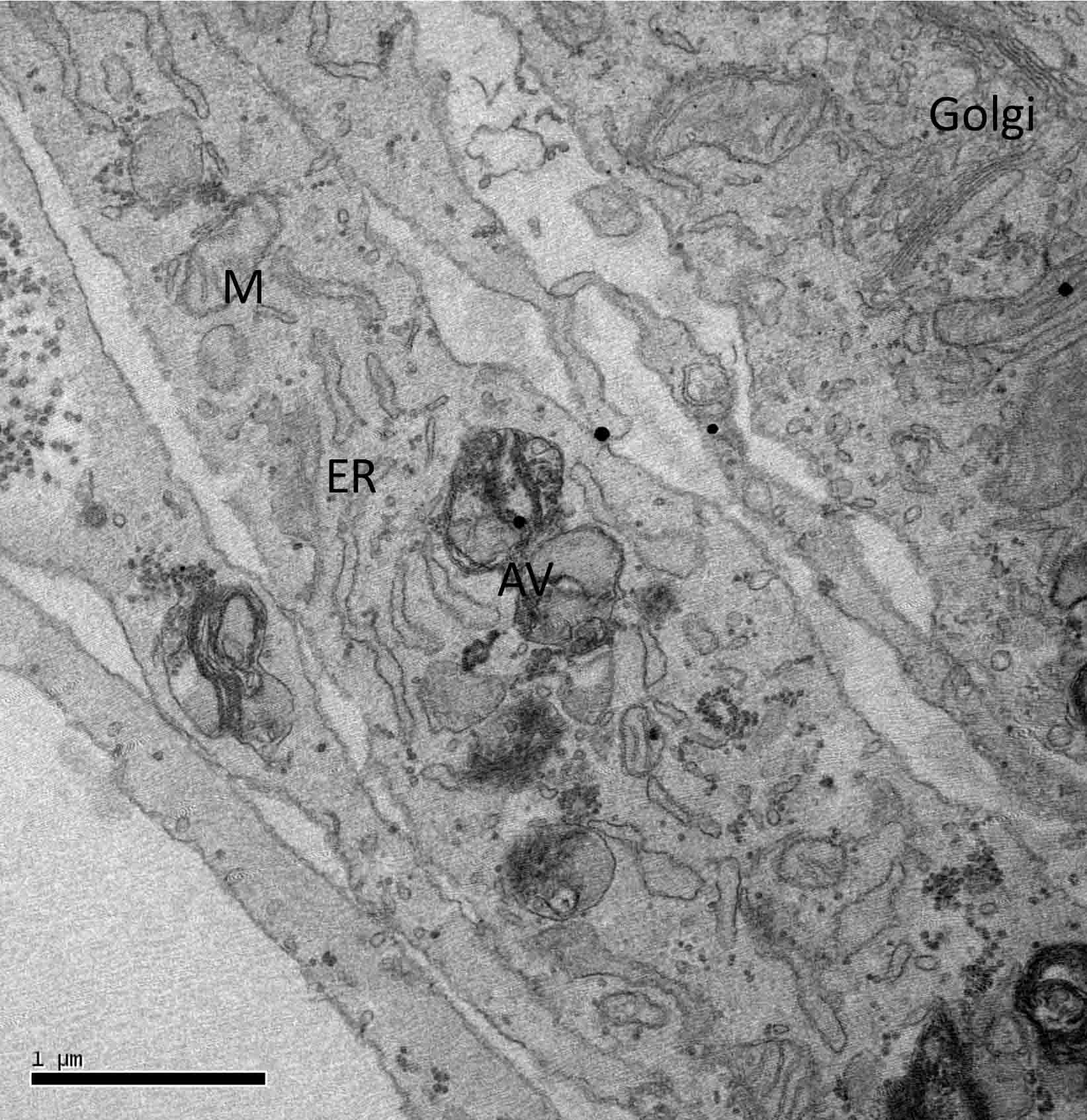 electron microscope image of a fibroblast cell