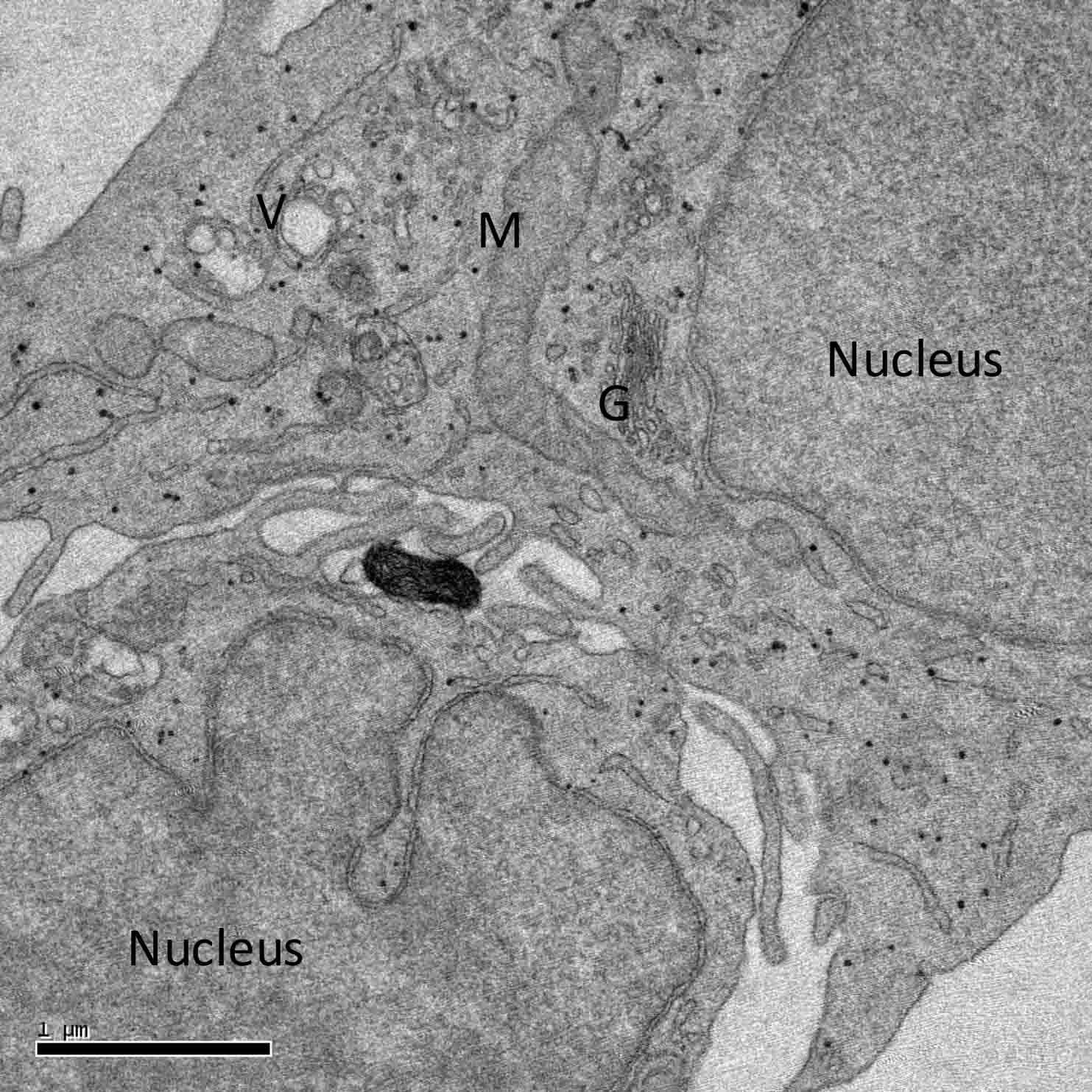 transmission electron micrograph of a keratinocyte culture