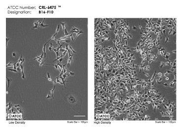 microscope images of B16 mouse melanoma cells