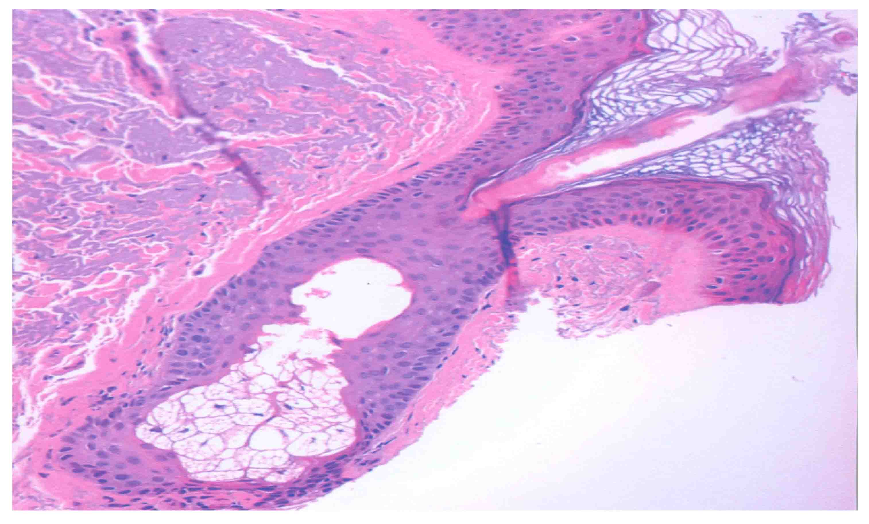 histological section of a sebaceous gland