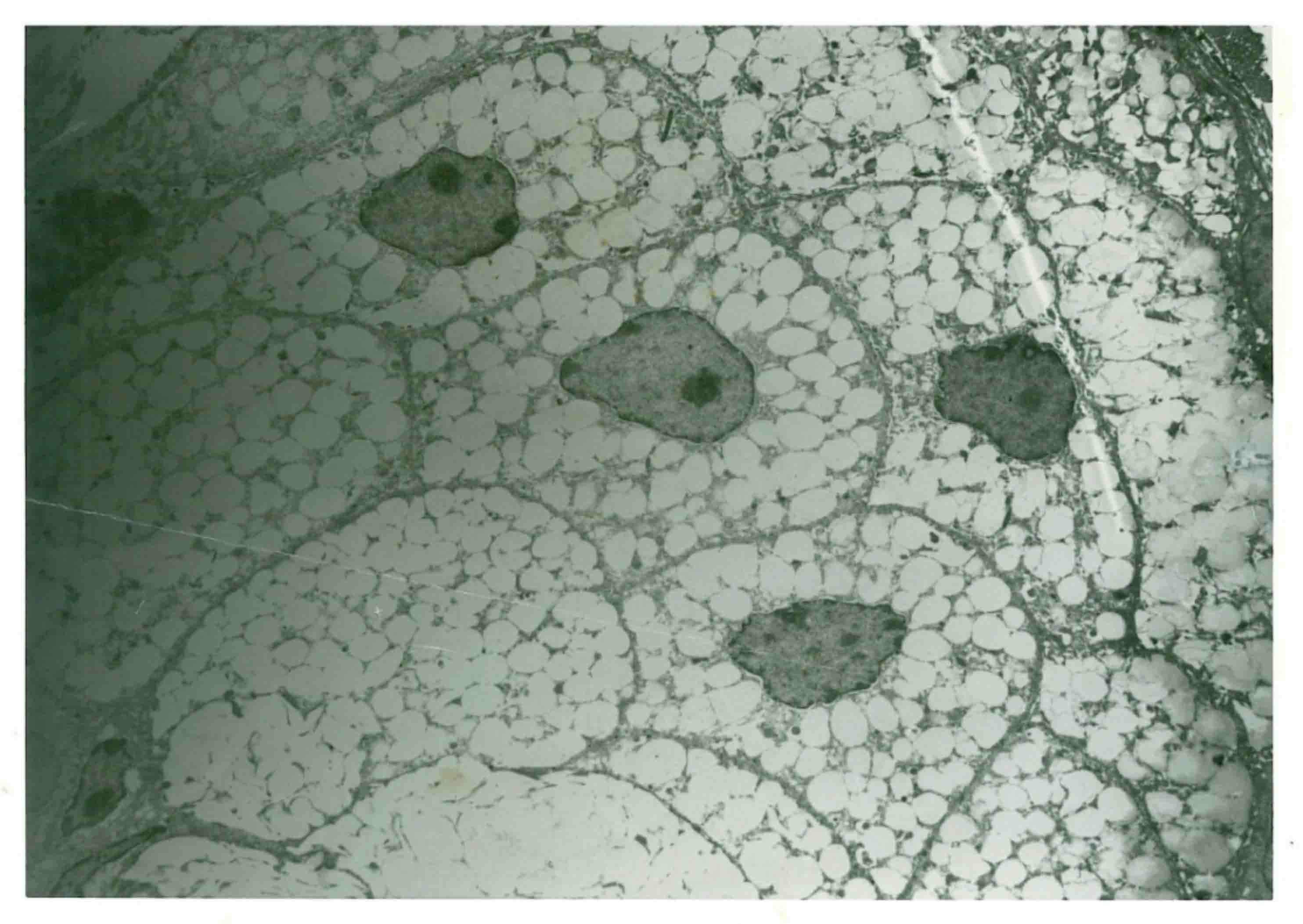 image of a sebaceous gland illustrating the sebocytes