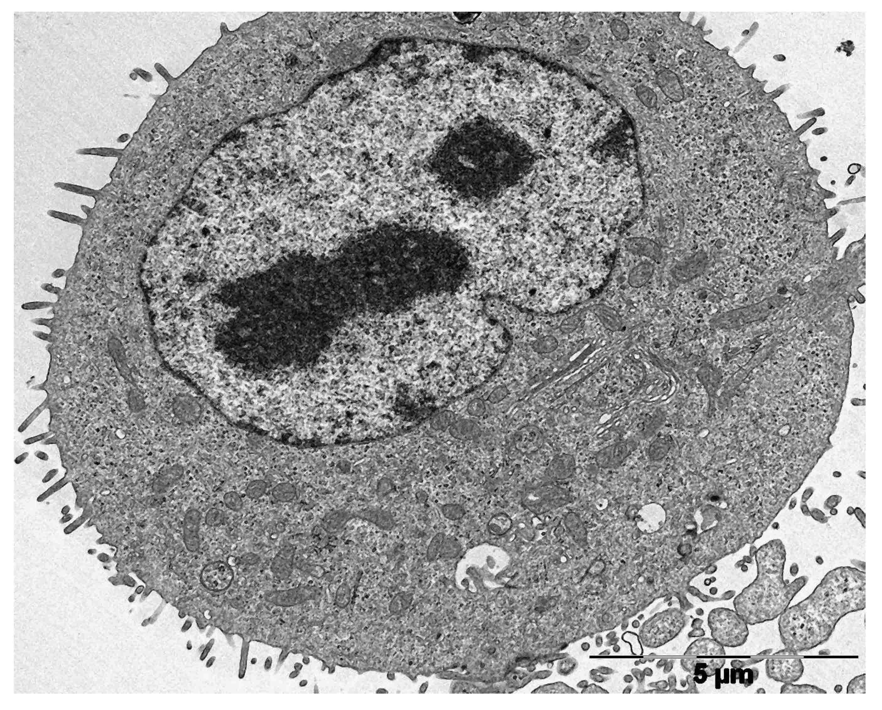 TEM image of a sebocyte