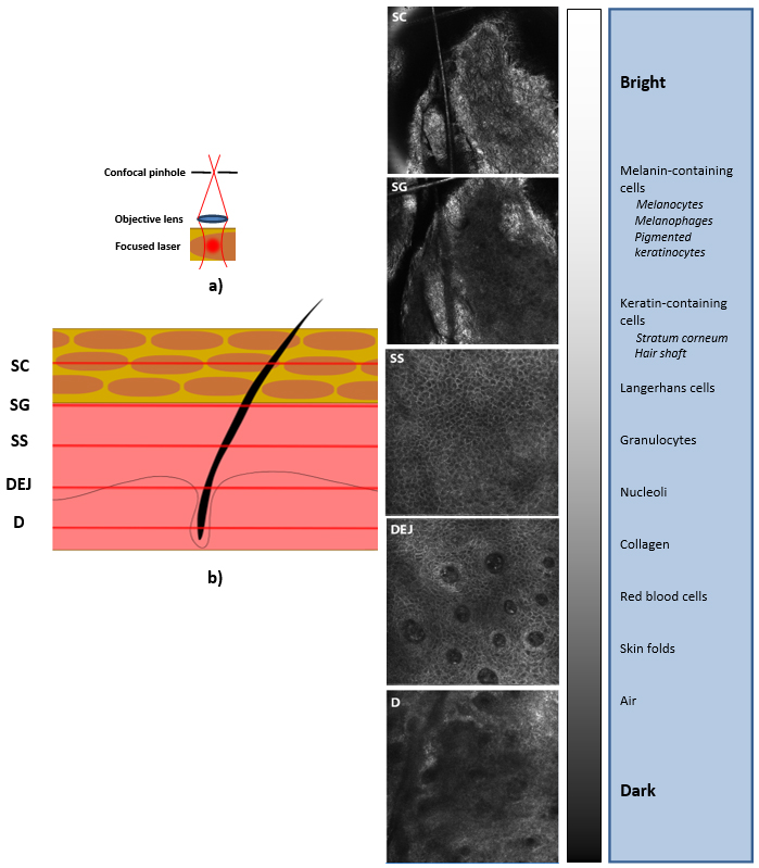 confocal imaging of skin illustration and images