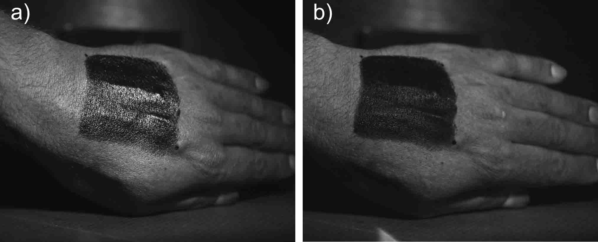 Comparison of a) non-polarised and b) cross polarised images of an SPF sunscreen film applied to skin